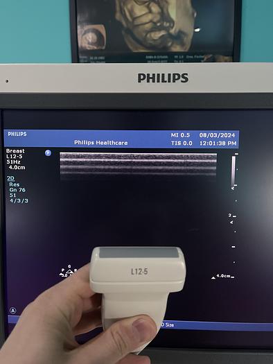 Gebraucht Philips HD15 Ultraschallgerät mit zwei Sonden 