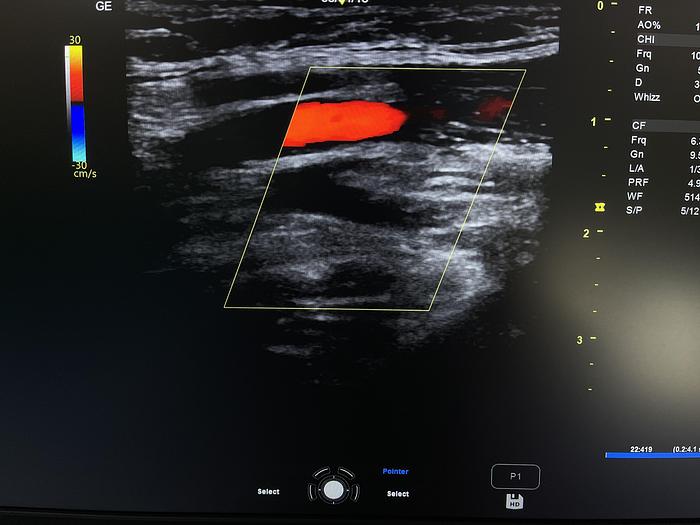 Gebraucht GE Versana Premier Ultraschallgerät mit drei Sonden