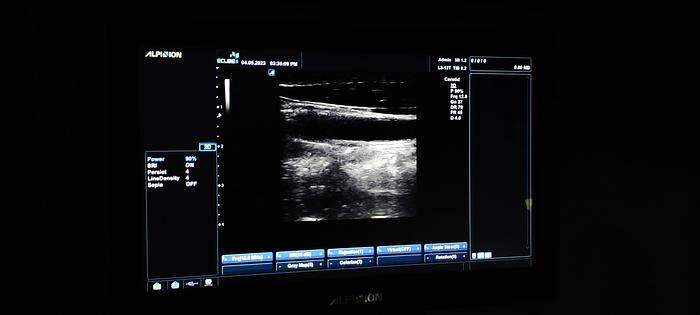 Gebraucht Alpinion ECUBE 5 Flachbildschirm-Ultraschallgerät inkl. 2 sonden Ultrasound