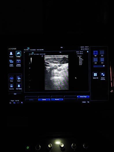 Gebraucht Alpinion E cube 9 Ultraschallgerät SW 2.6 mit 2 Sonde