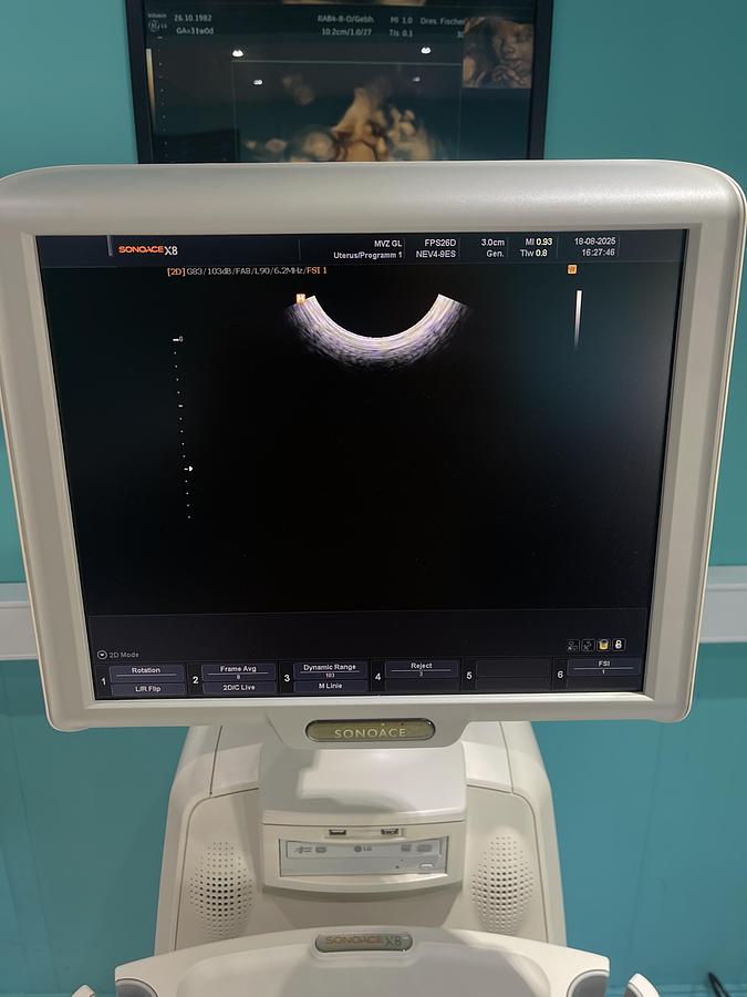 Gebraucht SonoAce X8 Ultraschallgerät mit drei Sonden und Drucker