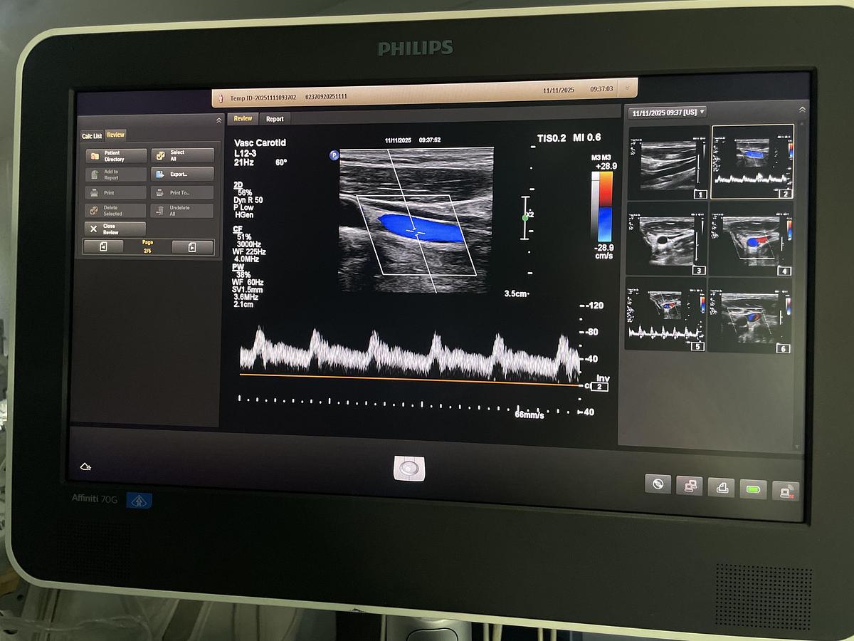 Gebraucht Philips L12-3 Linear Ultraschallsonde 