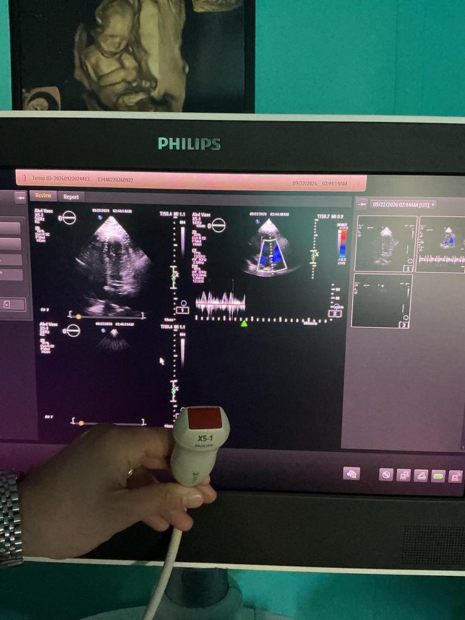 Gebraucht Philips X5-1 xMatrix Kardio Ultraschallsonde