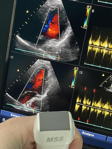 Gebraucht GE VIVID E9 Ultraschallgerät mit Kardiosonde