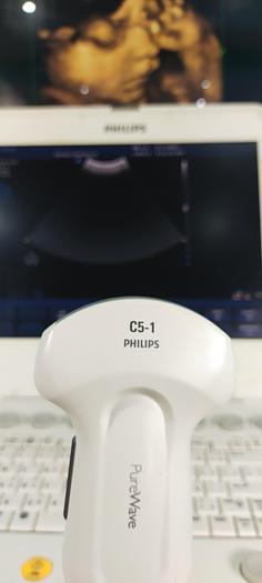 Gebraucht Philips CX50 Ultraschallgerät mit Konvex Sonde SW 2.5.1