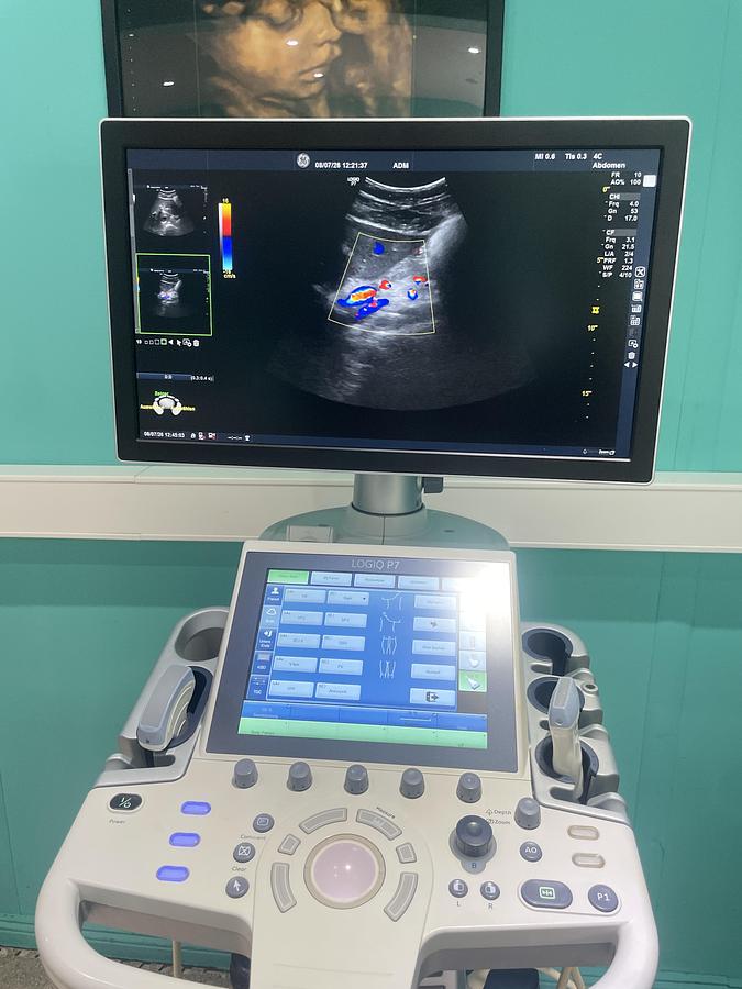 Gebraucht GE LOGIQ P7 Ultraschallgerät mit zwei Sonden