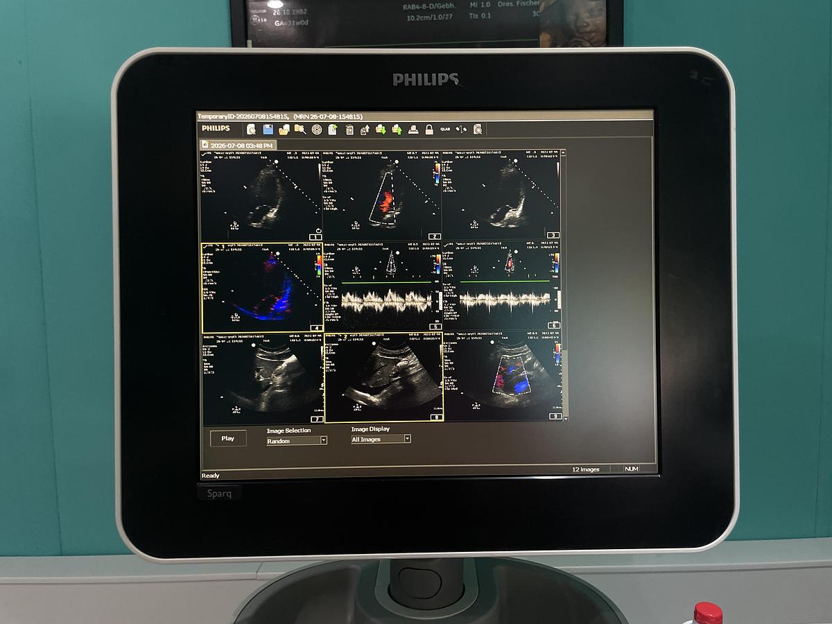 Gebraucht Philips Sparq Ultraschallgerät mit drei Sonden und Drucker