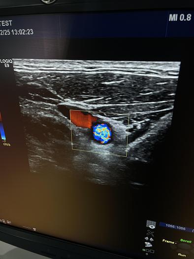 Gebraucht GE L11-D Linear Ultraschallsonde  