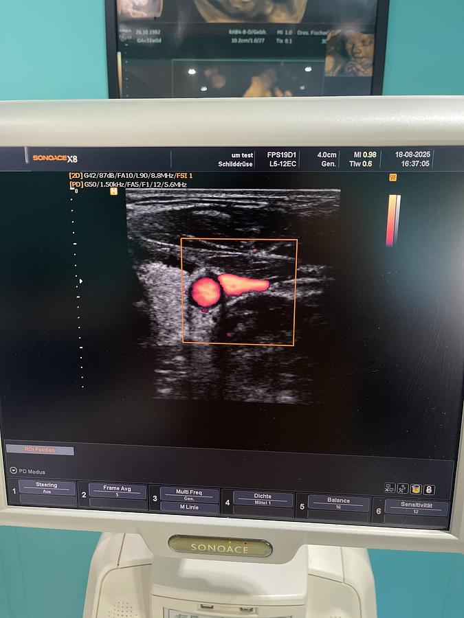 Gebraucht SonoAce X8 Ultraschallgerät mit drei Sonden und Drucker