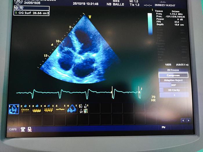 Gebraucht GE Vivid 7 Ultraschallgerät