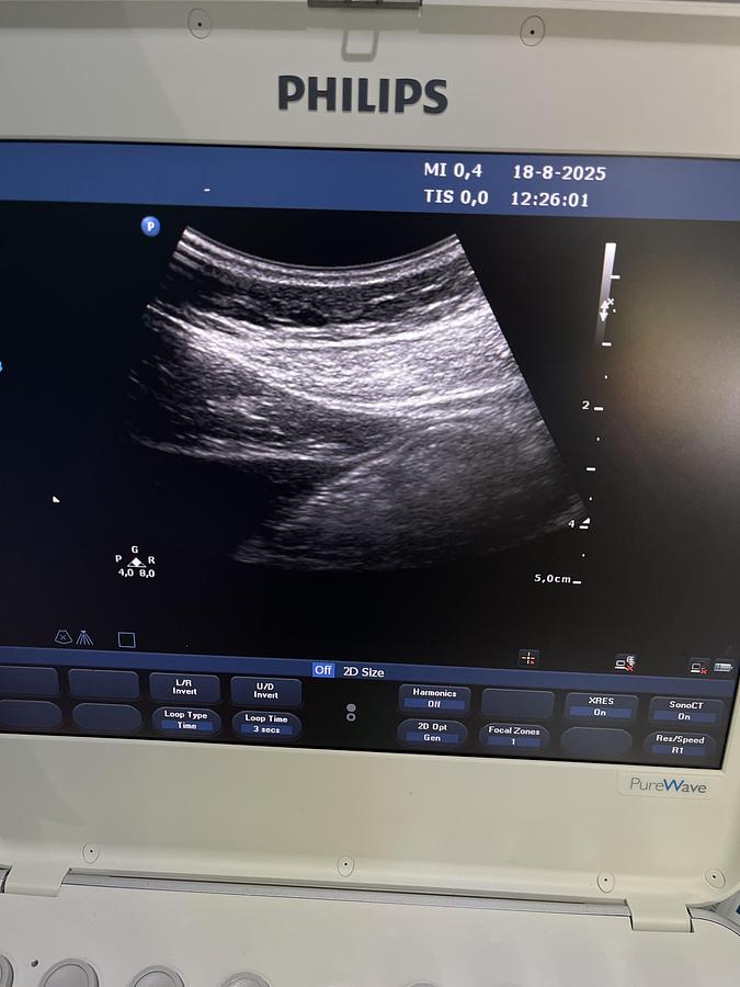 Gebraucht Philips C9-3io compact Ultraschallsonde