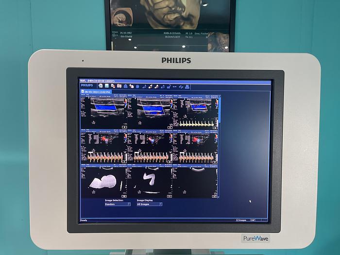 Gebraucht Philips HD15 Ultraschallgerät mit zwei Sonden 