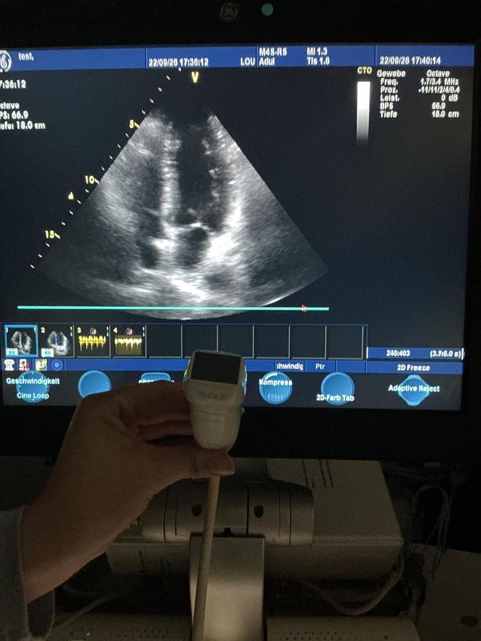 Gebraucht GE M4s-RS Kardio Ultraschallsonde