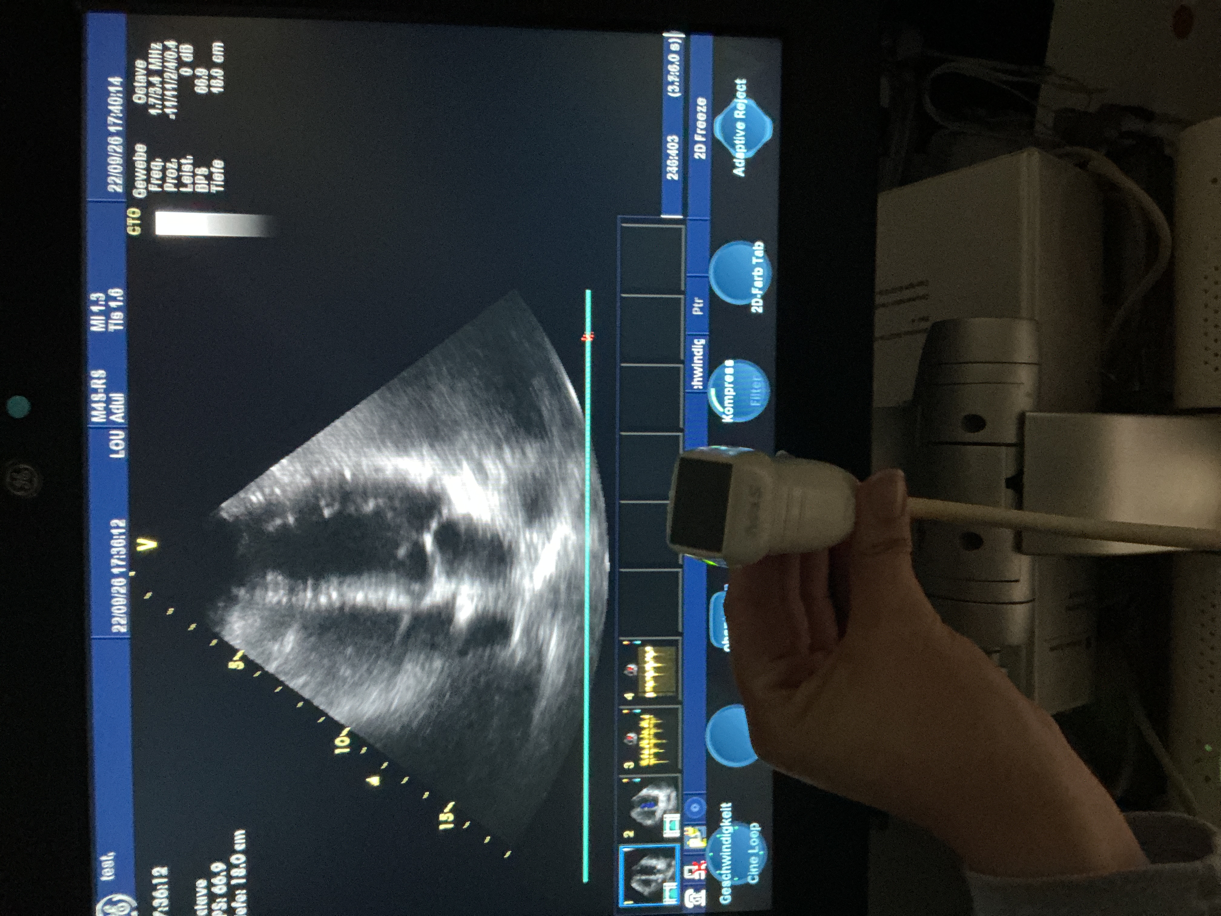 Gebraucht GE M4s-RS Kardio Ultraschallsonde