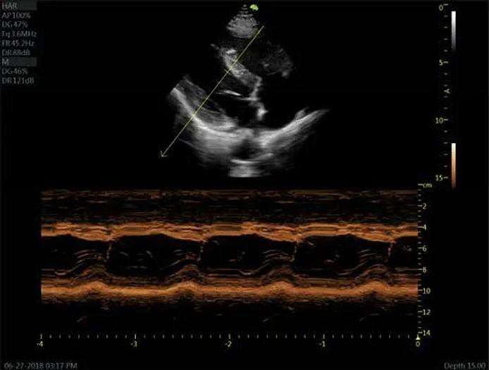 Gebraucht Vinno G55 Ultraschallgerät