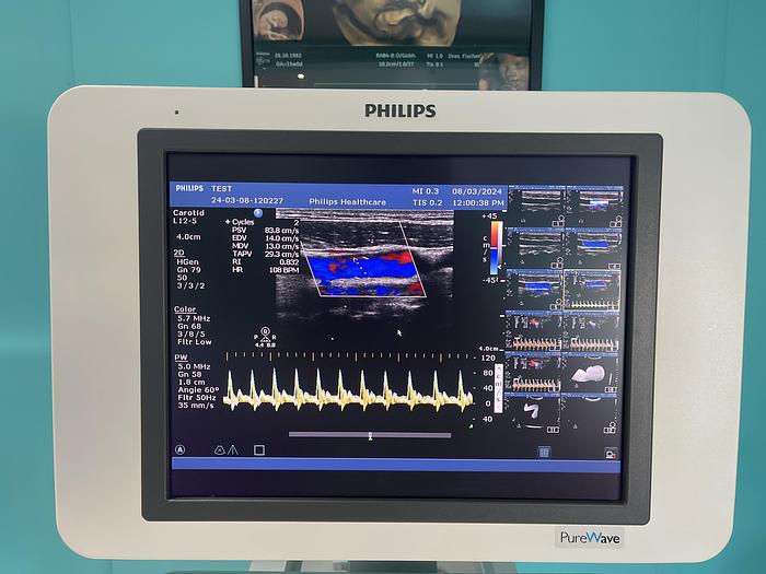 Gebraucht Philips HD15 Ultraschallgerät mit zwei Sonden 