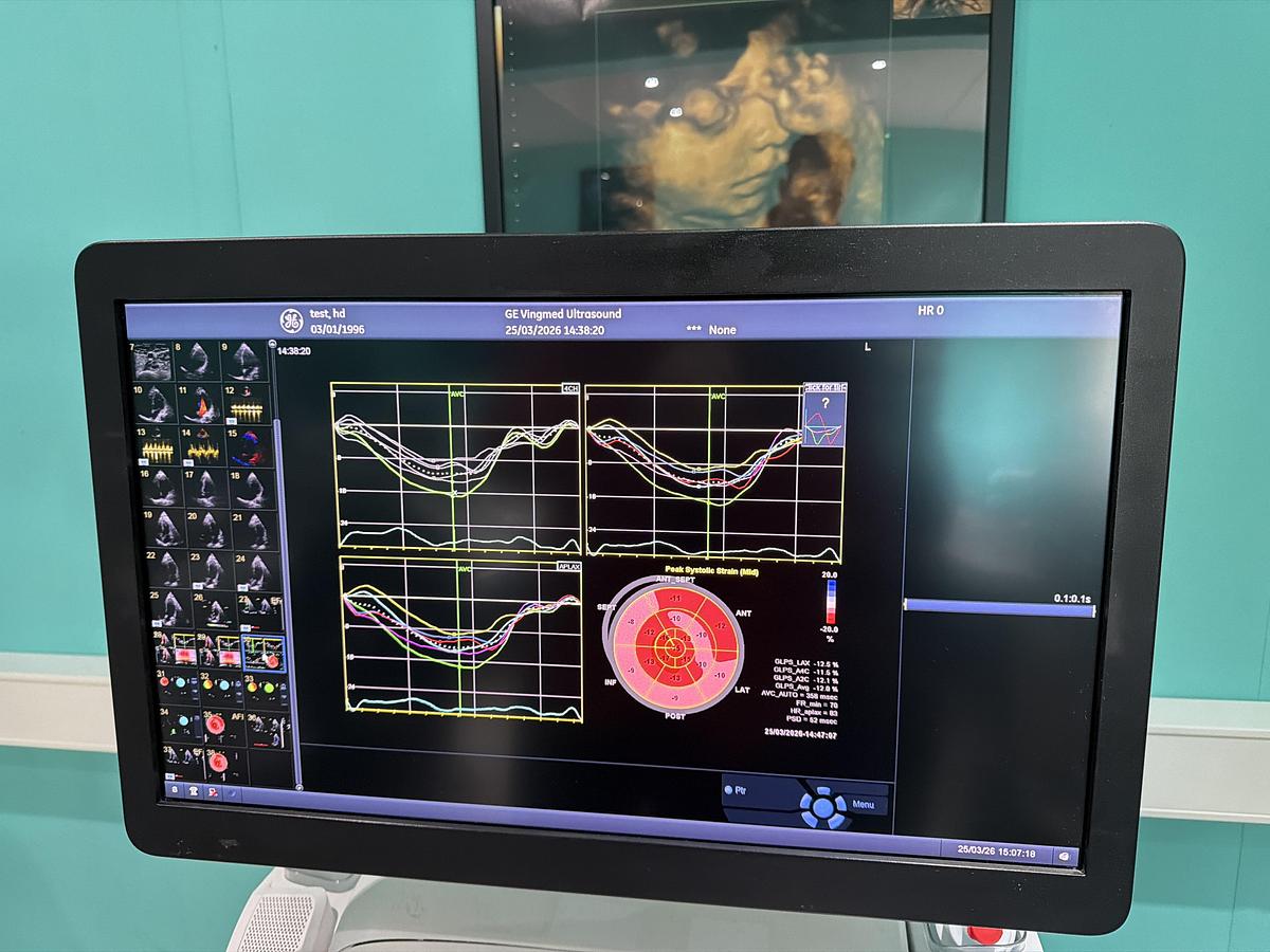 Gebraucht GE Vivid E95 v202 Ultraschallgerät mit zwei Sonden 