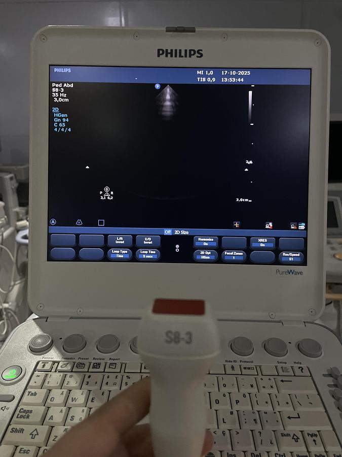 Gebraucht Philips S8-3 Kardio Ultraschallsonde