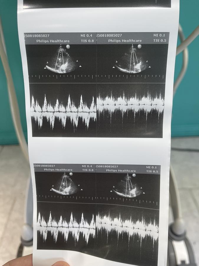 Gebraucht Philips CX50 Ultraschallgerät mit S5-1 Kardiosonde