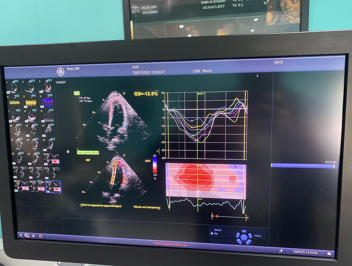 Gebraucht GE Vivid E95 V202 Ultraschallgerät mit M5Sc-D Kardiosonde