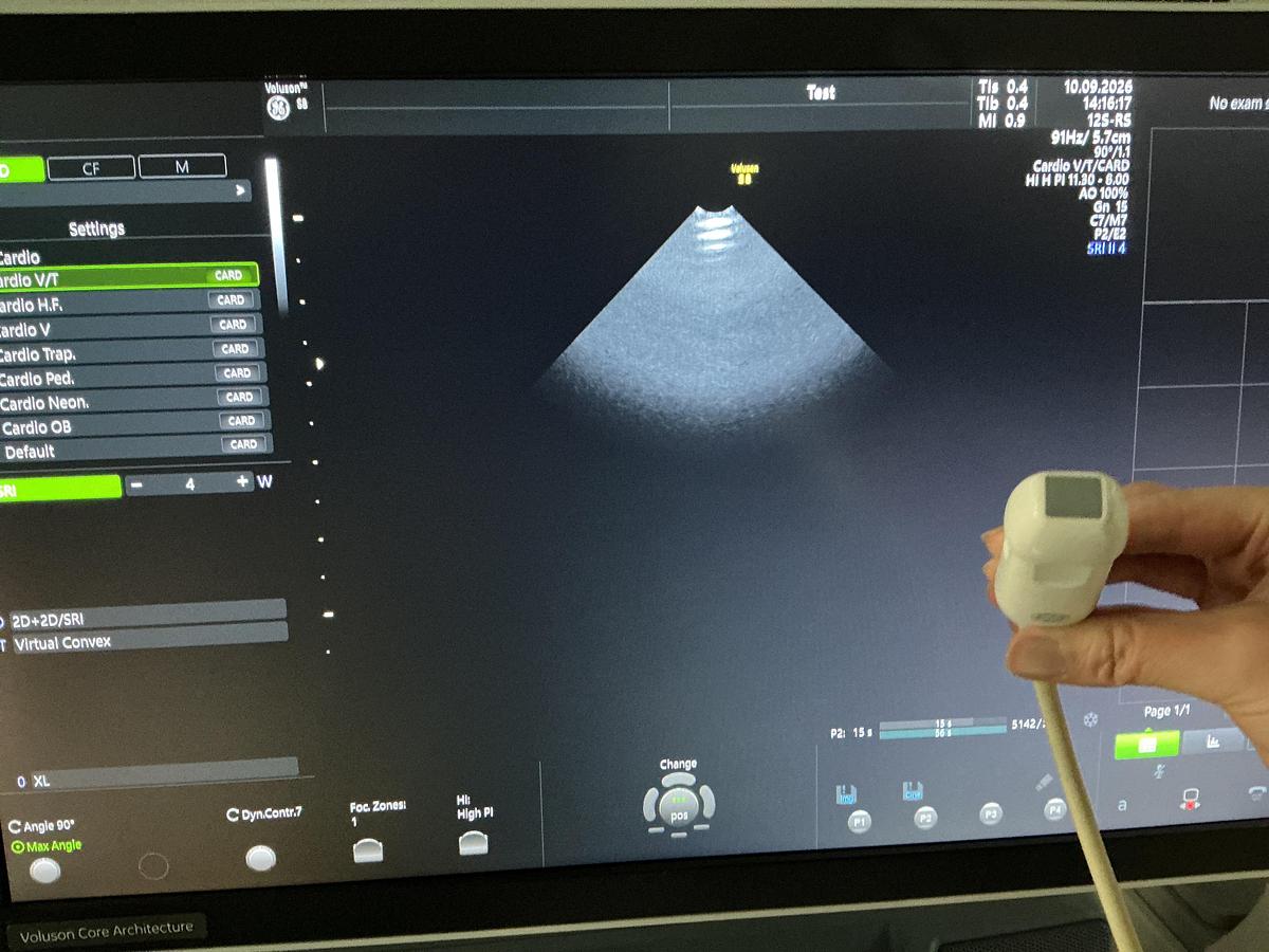 Gebraucht GE 12S-RS Kardio Ultraschallsonde