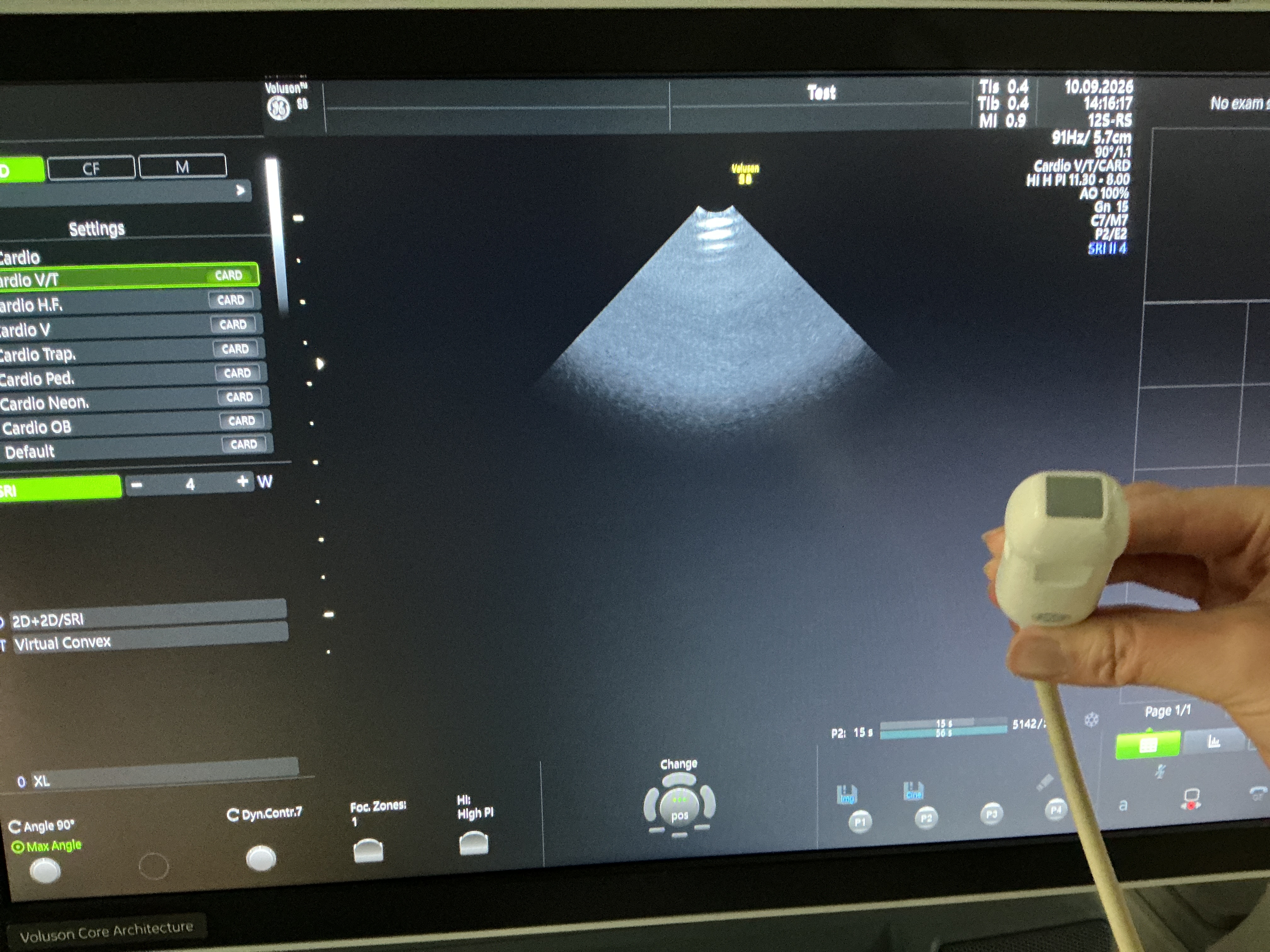 Gebraucht GE 12S-RS Kardio Ultraschallsonde