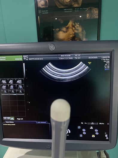 Gebraucht GE RIC5-9-D Endovaginal Ultraschallsonde 