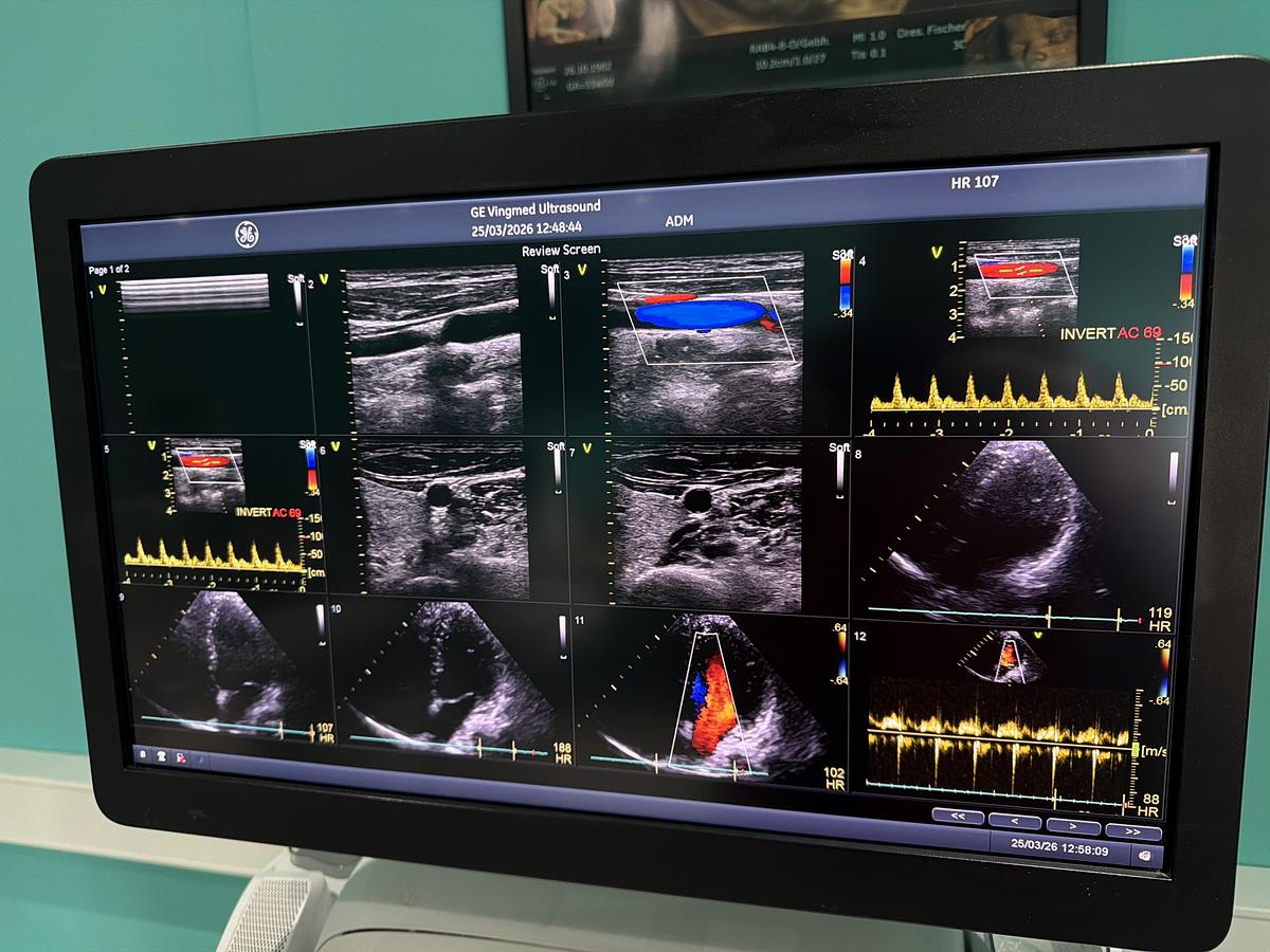 Gebraucht GE Vivid E95 v202 Ultraschallgerät mit zwei Sonden 