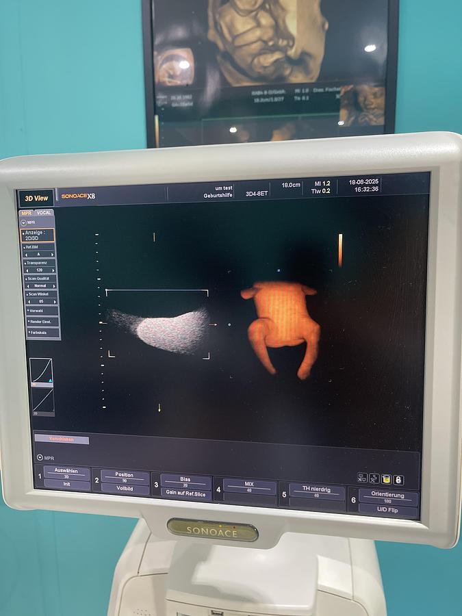 Gebraucht SonoAce X8 Ultraschallgerät mit drei Sonden und Drucker