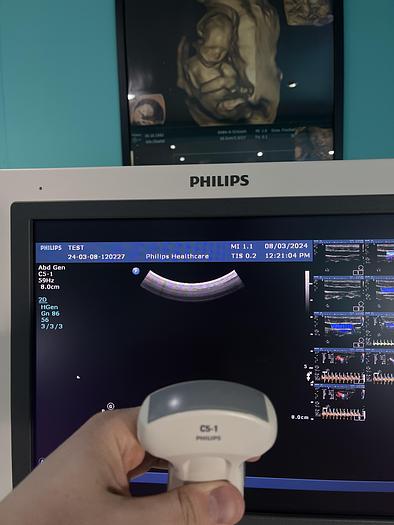 Gebraucht Philips HD15 Ultraschallgerät mit zwei Sonden 