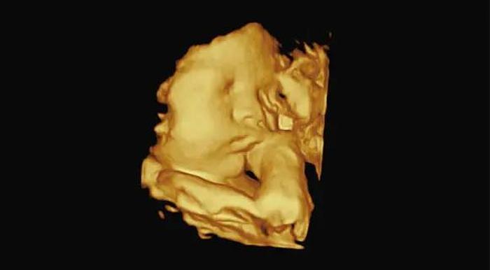 Vinno 5 tragbares Ultraschallgerät