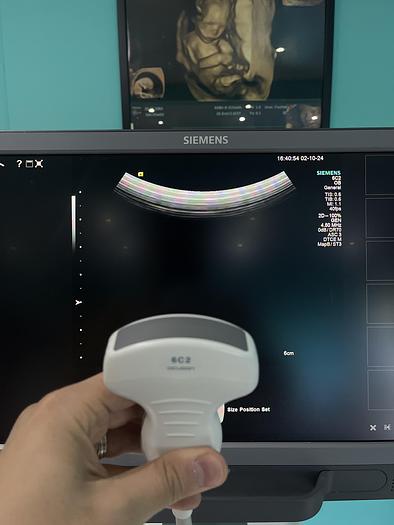 Used Siemens Acuson S1000 Ultraschallgerät mit drei Sonden 