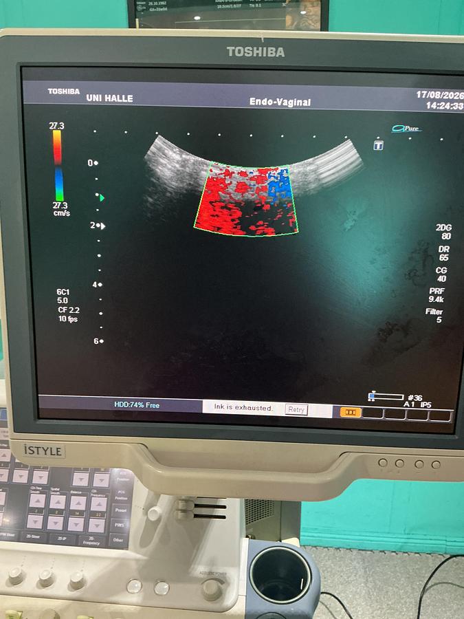 Gebraucht Toshiba iSTYLE Ultraschallgerät mit zwei Sonden 