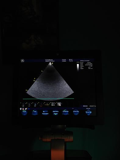 Gebraucht GE  Vivid S5  Ultraschallgerät auf Trolley mit 2 Sonden und EKG Kabel