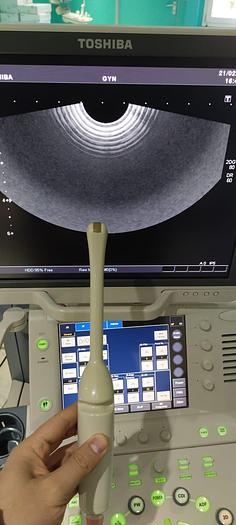 Gebraucht Toshiba aplio XG SSA-790A Ultraschallgerät ohne Sonden