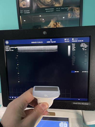 Gebraucht GE Vivid E9 XDclear Ultraschallgerät mit zwei Sonden und Drucker
