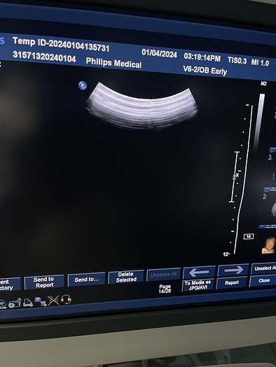 Gebraucht Philips iU22 Ultraschallgerät mit drei Ultraschallsonden