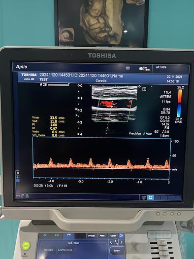 Used Toshiba Aplio 400 Ultraschallgerät mit 2 Sonden