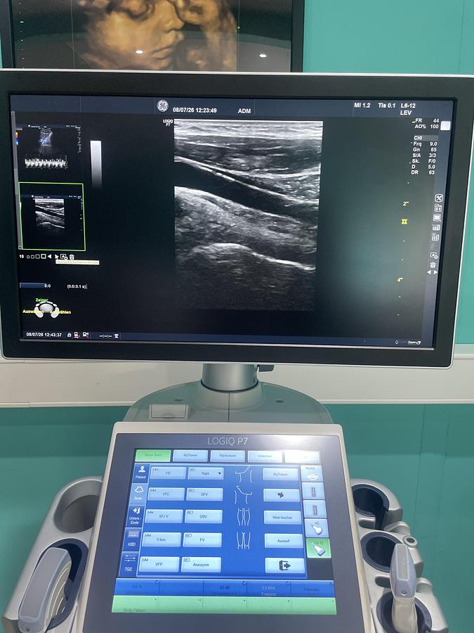 Gebraucht GE LOGIQ P7 Ultraschallgerät mit zwei Sonden