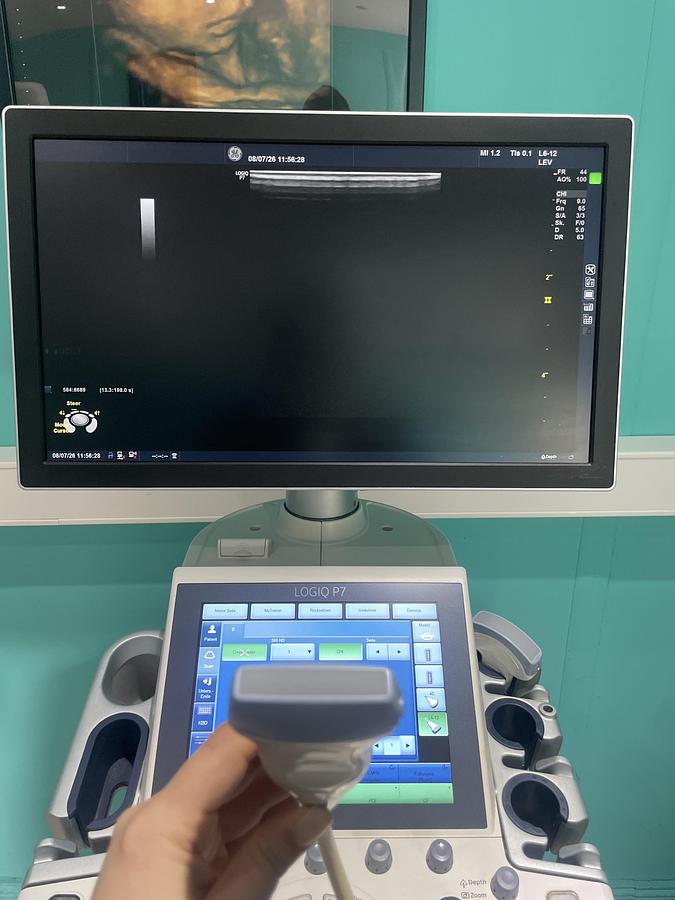 Gebraucht GE LOGIQ P7 Ultraschallgerät mit zwei Sonden