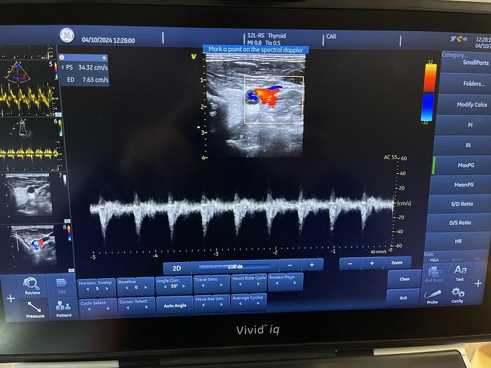Used GE 12L-RS linear Ultraschallsonde