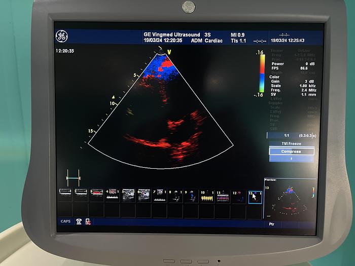 Gebraucht GE 3S Sektor Ultraschallsonde