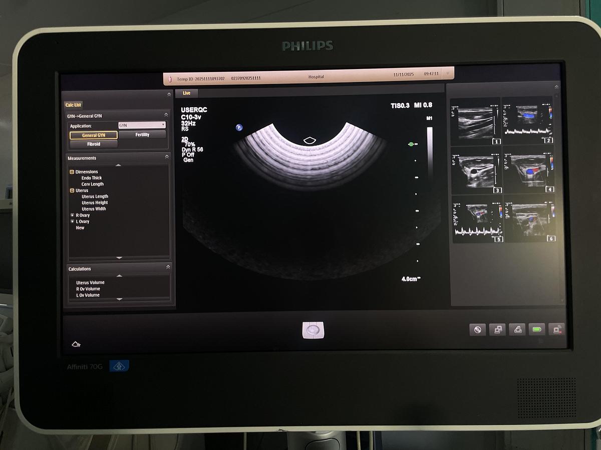 Gebraucht Philips C10-3V Endovaginal Ultraschallsonde 
