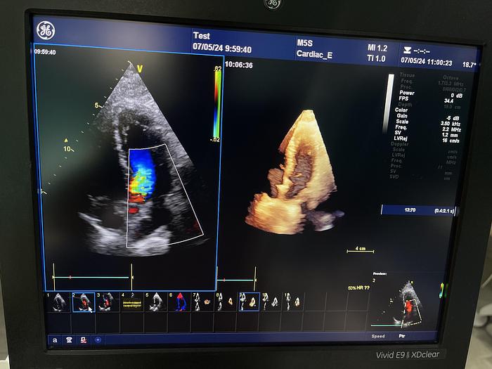 Gebraucht GE Vivid E9 XDClear Ultraschallgerät mit 2 Sonden