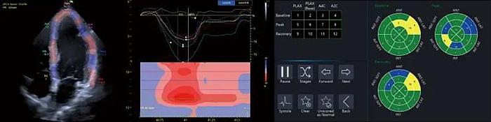 Vinno G86 diagnostisches Farbdoppler-Ultraschallsystem