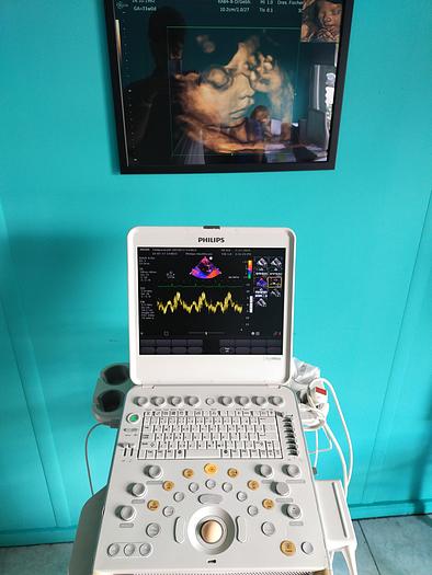 Gebraucht Philips CX50 Ultrasound with S5-1 and Trolly