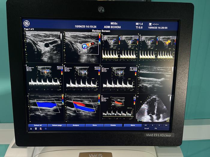 Gebraucht GE Vivid E9 XDclear Ultraschallgerät mit zwei Sonden und Drucker