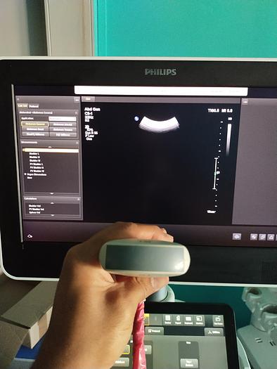 Gebraucht Philips C5-1 Ultraschallsonde