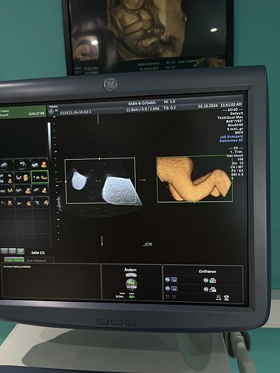 Used GE Voluson E8 Ultraschallgerät mit zwei Sonden und Drucker