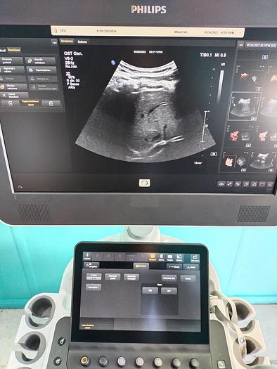 Gebraucht Philips V6-2  3D/4D  Volumen Ultraschallsonde